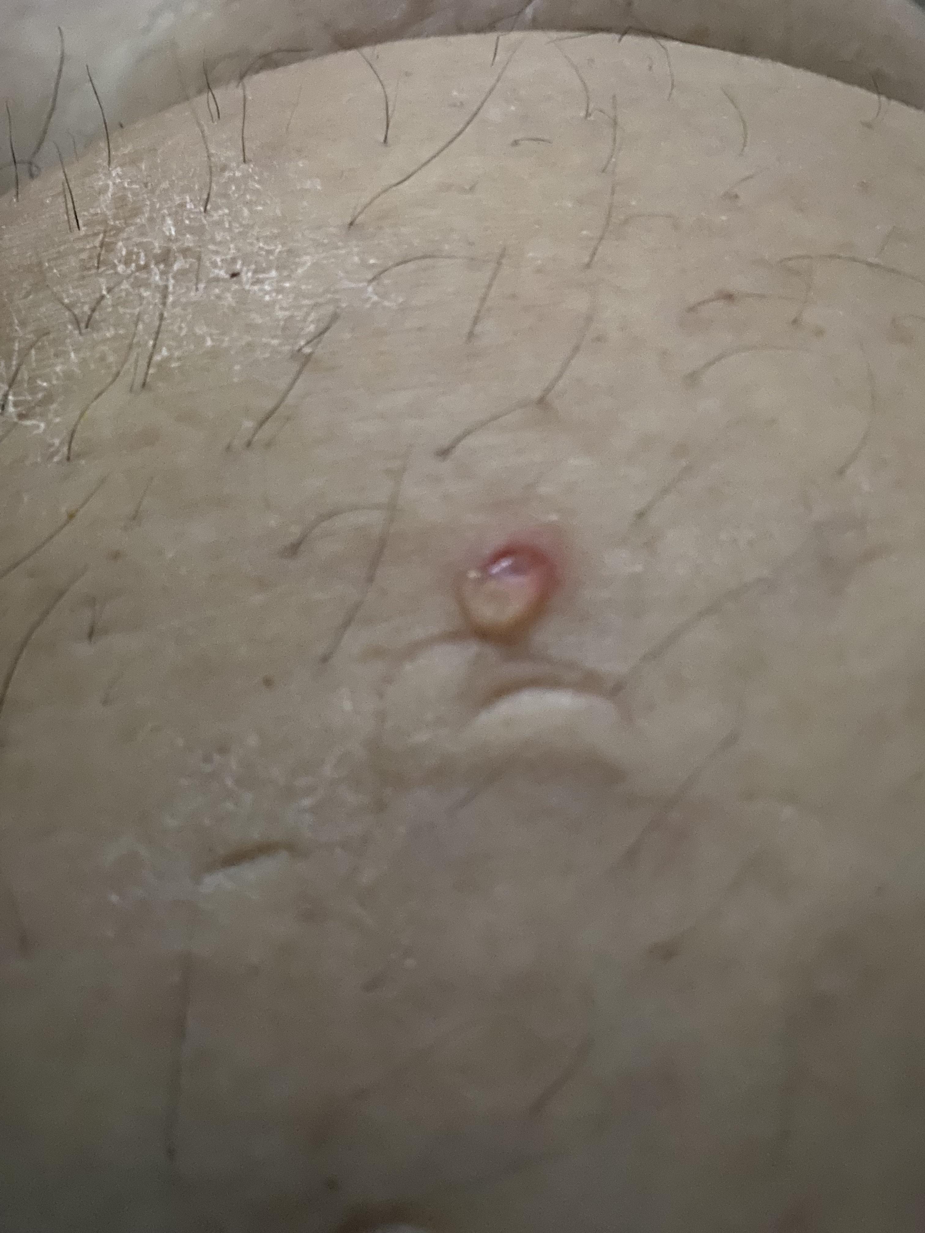 Cut Leaking Clear Fluid