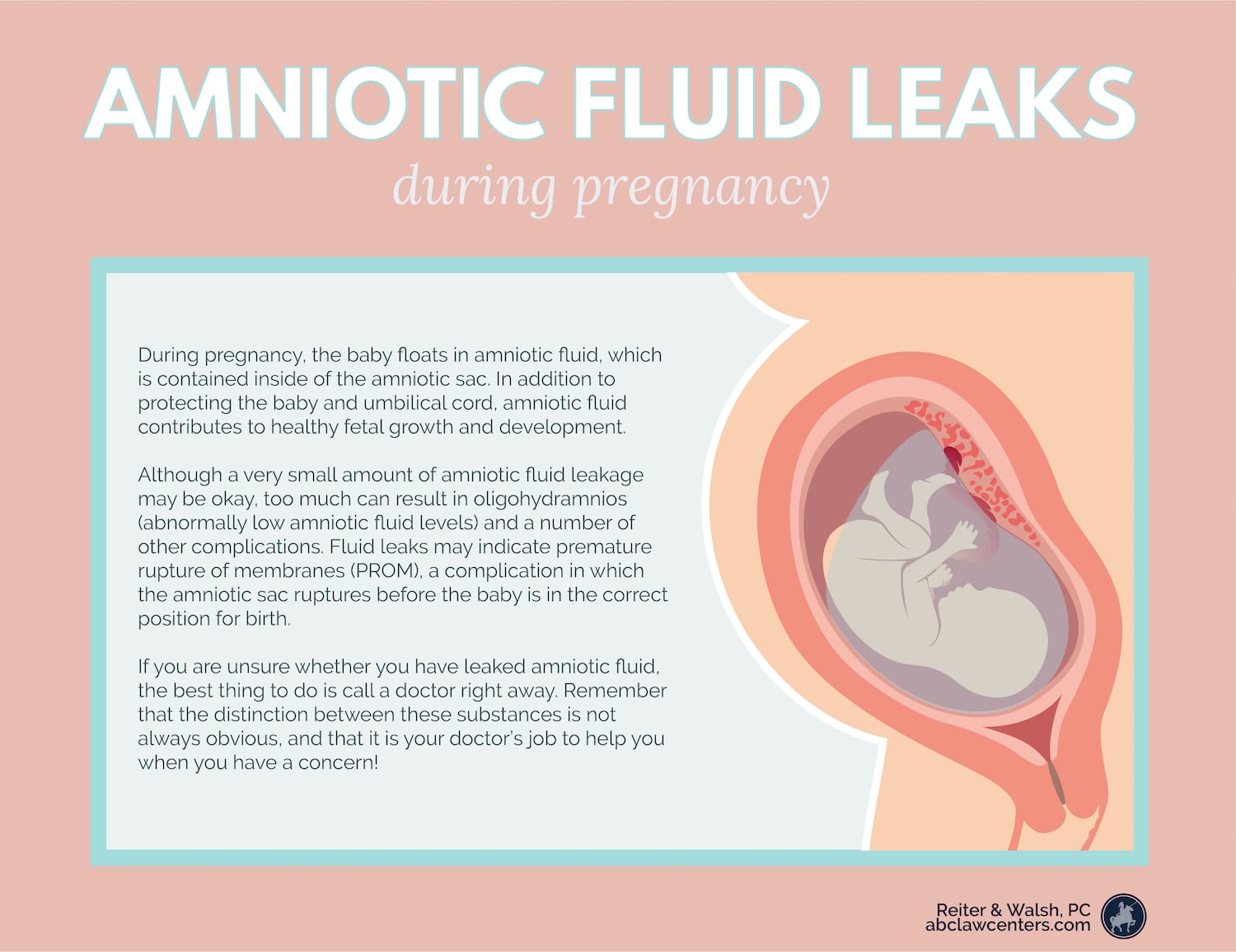 Water Leaking When Pregnant